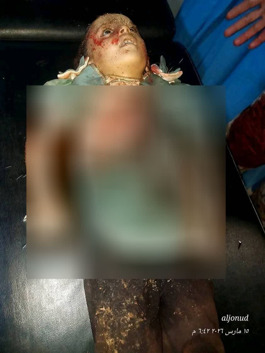 إدانة حقوقية للجريمة الحوثية التي أدت إلى استشهاد وإصابة أكثر من 30 مدنياً في حجة Image