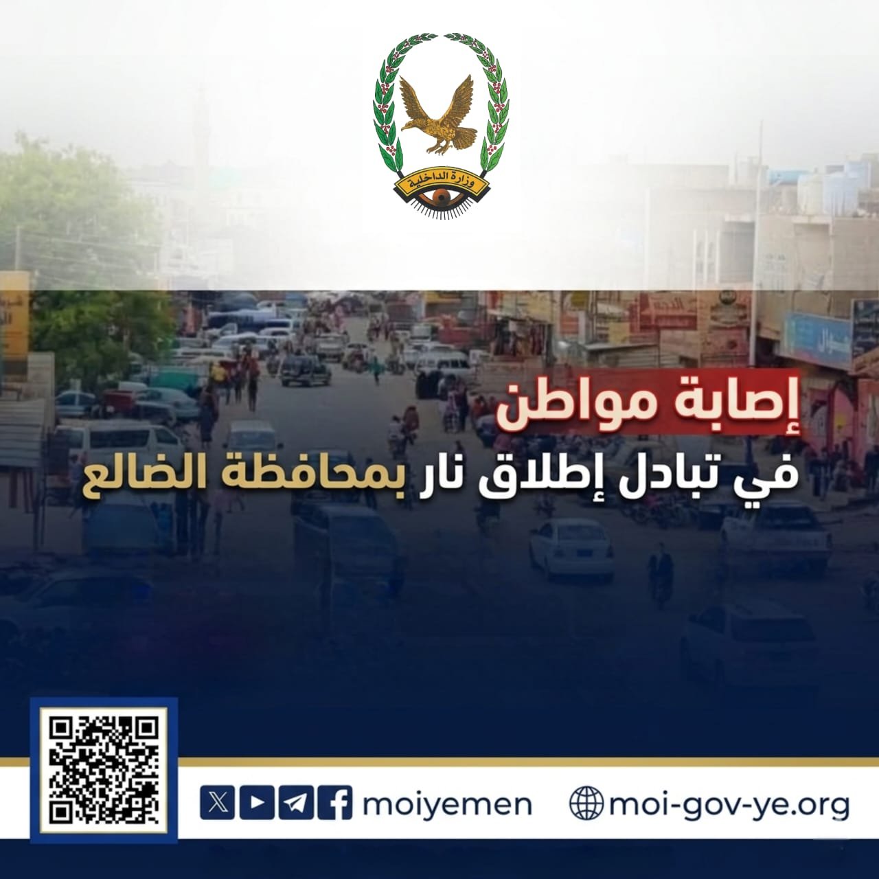 إصابة مواطن في تبادل إطلاق نار بمحافظة الضالع Image